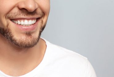 Esthetische Tandheelkunde